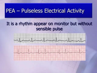 PEA – Pulseless Electrical Activity
It is a rhythm appear on monitor but without
sensible pulse
 
