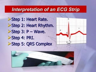Interpretation of an ECG Strip
Step 1: Heart Rate.
Step 2: Heart Rhythm.
Step 3: P – Wave.
Step 4: PRI.
Step 5: QRS Complex
 