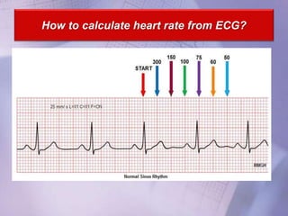 How to calculate heart rate from ECG?
 