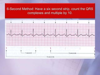 6-Second Method: Have a six second strip, count the QRS
complexes and multiple by 10.
 