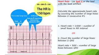 Heart Rate- Use lead II or the lead
with the least artifact.
Calculate the approximate heart rate
by counting the number of large boxes
between 2 consecutive R’s
1. Heart rate = 1500 ÷ number of
small boxes in RR interval
OR
2. Count the number of large boxes
between 2 QRS
Heart rate = 300 ÷ number of large
boxes between QRS
 
