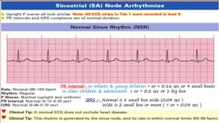 PR interval- In infants & young children > or = 0.16 sec or 4 small boxes
In older children & adolescents > or = 0.2 sec or 1 big box
QRS :- Normal is 1 small box wide (0.04 sec )
Wide is 2 small box or more ( > or = 0.08 sec )
 