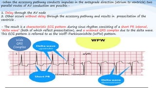 -When the accessory pathway conducts impulses in the antegrade direction (atrium to ventricle) two
parallel routes of AV conduction are possible:-
1. Delay through the AV node
2. Other occurs without delay through the accessory pathway and results in preexcitation of the
ventricle .
- The result is a characteristic ECG pattern during sinus rhythm consisting of a short PR interval,
"delta wave" (both of which reflect preexcitation), and a widened QRS complex due to the delta wave.
This ECG pattern is referred to as the Wolff-ParkinsonWhite (WPW) pattern.
Wide
QRS
Complex
 