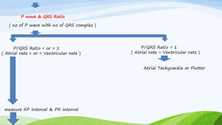 P wave & QRS Ratio
( no of P wave with no of QRS complex )
P/QRS Ratio < or = 1
( Atrial rate < or = Ventricular rate )
P/QRS Ratio > 1
( Atrial rate > Ventricular rate )
Atrial Tachycardia or Flutter
measure RP interval & PR interval
 