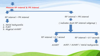 Measure RP interval & PR interval
RP interval > PR interval RP interval < PR interval
1. Atrial tachycardia
2. PJRT
3. Atypical AVNRT
( indicates short RP interval subgroup )
RP interval < 0.7 second RP interval > 0.7 seconds
AVNRT AVRT / AVNRT / Atrial tachycardia
 
