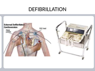 Cardiac arrythmia in children; Dr Pendeza.pptx