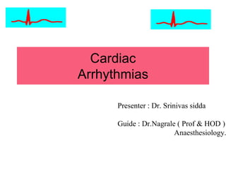 Cardiac
Arrhythmias
Presenter : Dr. Srinivas sidda
Guide : Dr.Nagrale ( Prof & HOD )
Anaesthesiology.
 