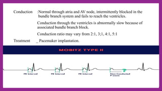 cardiac arrythmias .my presentation (1) - Copy.pptx
