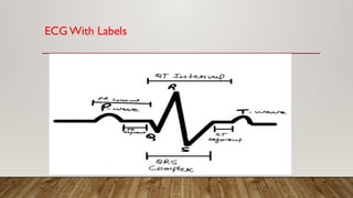 ECG With Labels
 