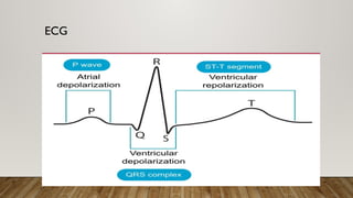 ECG
 