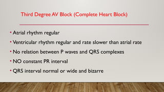 Third Degree AV Block (Complete Heart Block)
• Atrial rhythm regular
• Ventricular rhythm regular and rate slower than atrial rate
• No relation between P waves and QRS complexes
• NO constant PR interval
• QRS interval normal or wide and bizarre
 
