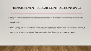 PREMATUREVENTRICULAR CONTRACTIONS (PVC)
• Early or premature ventricular contractions are caused by increased automaticity of ventricular
muscle cells.
• PVCS usually are not considered harmful but are of concern if more than six occur in 1 minute, if
they occur in pairs or triplets if they are multifocal or if they occur or near a t wave.
 