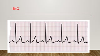 EKG
 