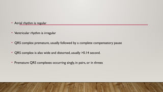 • Atrial rhythm is regular
• Ventricular rhythm is irregular
• QRS complex premature, usually followed by a complete compensatory pause
• QRS complex is also wide and distorted, usually >0.14 second.
• Premature QRS complexes occurring singly, in pairs, or in threes
 