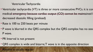 Ventricular Tachycardia
• Ventricular tachycardia (VT) is three or more consecutive PVCs. it is con
medical emergency because cardiac output (CO) cannot be maintained b
decreased diastolic filling (preload)
• Rate is 100 to 250 beats per minute
• P wave is blurred in the QRS complex but the QRS complex has no asso
P wave.
• PR Interval is not present
• QRS complex is wide and bizarre;T wave is in the opposite direction
• Rhythm is usually regular
 