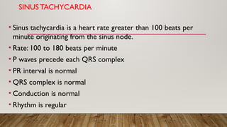 SINUS TACHYCARDIA
• Sinus tachycardia is a heart rate greater than 100 beats per
minute originating from the sinus node.
• Rate: 100 to 180 beats per minute
• P waves precede each QRS complex
• PR interval is normal
• QRS complex is normal
• Conduction is normal
• Rhythm is regular
 