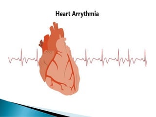 Cardiac Arrhythmia 
