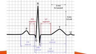 CARDIAC ARRYTHMIAS AND ITS NURSING MANAGEMENT | PPTX