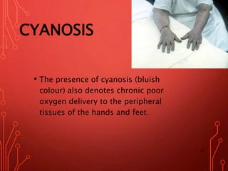 Cyantic Cardiac and vascular assessment | PPTX