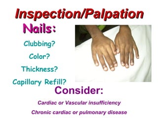 Inspection/Palpation
   Nails:
   Clubbing?
     Color?
  Thickness?
Capillary Refill?
              Consider:
       Cardiac or Vascular insufficiency
     Chronic cardiac or pulmonary disease
 
