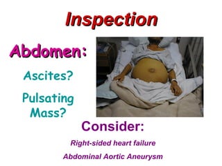 Inspection
Abdomen:
 Ascites?
 Pulsating
  Mass?
             Consider:
         Right-sided heart failure
        Abdominal Aortic Aneurysm
 