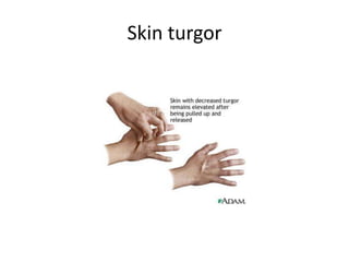 Skin turgor

 