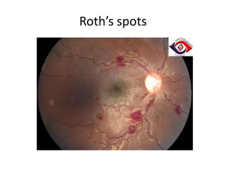 Roth’s spots

 