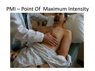 PMI – Point Of Maximum Intensity

 