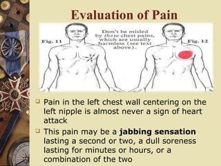 Evaluation of Pain
 Pain in the left chest wall centering on the
left nipple is almost never a sign of heart
attack
 This pain may be a jabbing sensation
lasting a second or two, a dull soreness
lasting for minutes or hours, or a
combination of the two
 