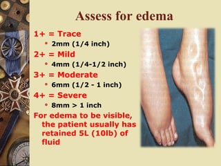Assess for edema
1+ = Trace
 2mm (1/4 inch)
2+ = Mild
 4mm (1/4-1/2 inch)
3+ = Moderate
 6mm (1/2 - 1 inch)
4+ = Severe
 8mm > 1 inch
For edema to be visible,
the patient usually has
retained 5L (10lb) of
fluid
 