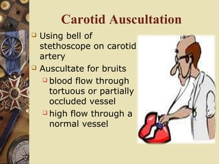Carotid Auscultation
 Using bell of
stethoscope on carotid
artery
 Auscultate for bruits
 blood flow through
tortuous or partially
occluded vessel
 high flow through a
normal vessel
 