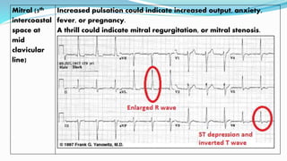 Mitral (5th
intercoastal
space at
mid
clavicular
line)
Increased pulsation could indicate increased output, anxiety,
fever, or pregnancy.
A thrill could indicate mitral regurgitation, or mitral stenosis.
 