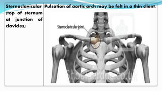 Sternoclavicular
(top of sternum
at junction of
clavicles)
Pulsation of aortic arch may be felt in a thin client.
 