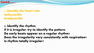 2. Identify the heart rate.
tachycardia
bradycardia
3. Identify the rhythm.
if it is irregular, try to identify the pattern.
Do early beats appear on a regular rhythm?
Does the irregularity vary consistently with respiration?
Is rhythm totally irregular?
Contd…….
 