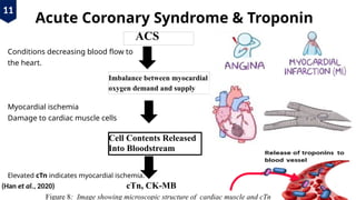 CARDIAC BIOMAKERS AND THEIR ROLE IN Management of cardiovascular ...