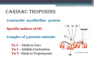 Comprehensive Overview of Cardiac Biomarkers in Myocardial Infarction ...