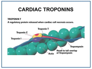 CARDIAC TROPONINS
 