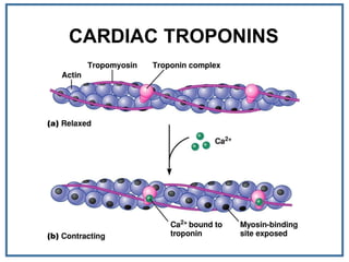 CARDIAC TROPONINS
 