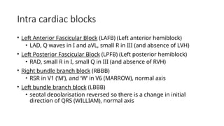 Comprehensive Overview of Cardiac Conduction Blocks and Their ECG ...