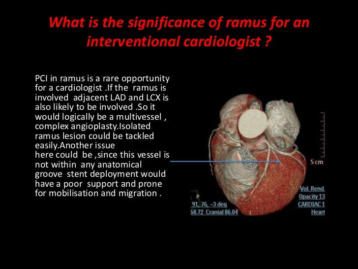 Cardiac case series ramus intermedius
