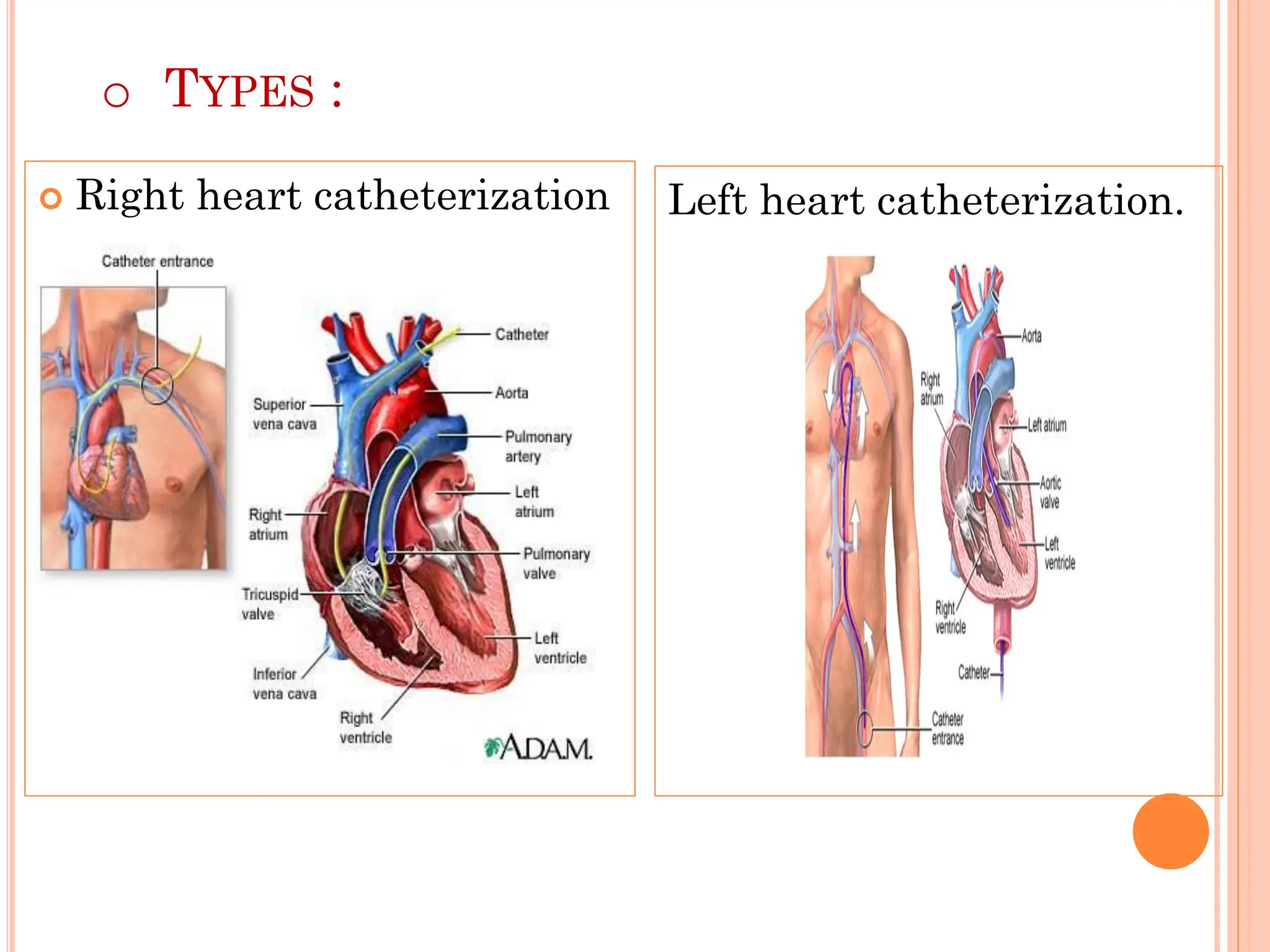 cardiac catheterizatio n 2.pdf