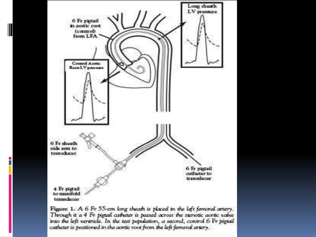 Cardiac catheterization at a glance (including instruments, view, dye)