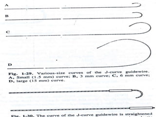 J-curve guidewire
44
 