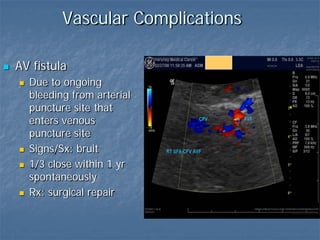 Vascular Complications
 AV fistula
 Due to ongoing
bleeding from arterial
puncture site that
enters venous
puncture site
 Signs/Sx: bruit
 1/3 close within 1 yr
spontaneously
 Rx: surgical repair
 