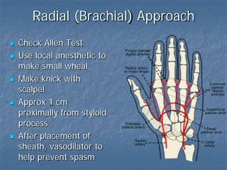 Radial (Brachial) Approach
 Check Allen Test
 Use local anesthetic to
make small wheal
 Make knick with
scalpel
 Approx 1 cm
proximally from styloid
process
 After placement of
sheath, vasodilator to
help prevent spasm
 
