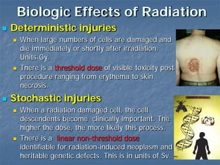 Biologic Effects of Radiation
 Deterministic injuries
 When large numbers of cells are damaged and
die immediately or shortly after irradiation.
Units-Gy.
 There is a threshold dose of visible toxicity post
procedure ranging from erythema to skin
necrosis.
 Stochastic injuries
 When a radiation damaged cell, the cell
descendents become clinically important. The
higher the dose, the more likely this process.
 There is a linear non-threshold dose
identifiable for radiation-induced neoplasm and
heritable genetic defects. This is in units of Sv.
 