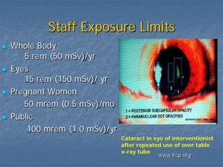 Staff Exposure Limits
 Whole Body
5 rem (50 mSv)/yr
 Eyes
15 rem (150 mSv)/ yr
 Pregnant Women
50 mrem (0.5 mSv)/mo
 Public
100 mrem (1.0 mSv)/yr
Cataract in eye of interventionist
after repeated use of over table
x-ray tube
www.ircp.org
 