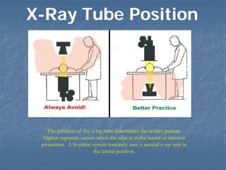 The position of the x-ray tube determines the scatter pattern.
Higher exposure occurs when the tube is in the lateral or anterior
projection. A bi-plane system routinely uses a second x-ray unit in
the lateral position.
X-Ray Tube Position
 