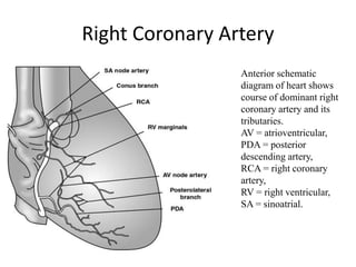 Right Coronary Artery
Anterior schematic
diagram of heart shows
course of dominant right
coronary artery and its
tributaries.
AV = atrioventricular,
PDA = posterior
descending artery,
RCA = right coronary
artery,
RV = right ventricular,
SA = sinoatrial.
 