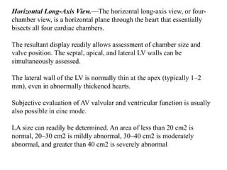 Horizontal Long-Axis View.—The horizontal long-axis view, or four-
chamber view, is a horizontal plane through the heart that essentially
bisects all four cardiac chambers.
The resultant display readily allows assessment of chamber size and
valve position. The septal, apical, and lateral LV walls can be
simultaneously assessed.
The lateral wall of the LV is normally thin at the apex (typically 1–2
mm), even in abnormally thickened hearts.
Subjective evaluation of AV valvular and ventricular function is usually
also possible in cine mode.
LA size can readily be determined. An area of less than 20 cm2 is
normal, 20–30 cm2 is mildly abnormal, 30–40 cm2 is moderately
abnormal, and greater than 40 cm2 is severely abnormal
 
